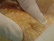 13060608384715263611266087 dans Nouvelle-Calédonie