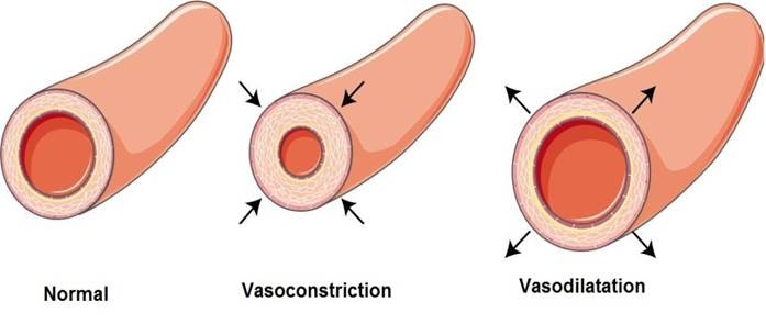 vasoconstriction