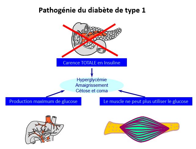 pathogenie du diabete