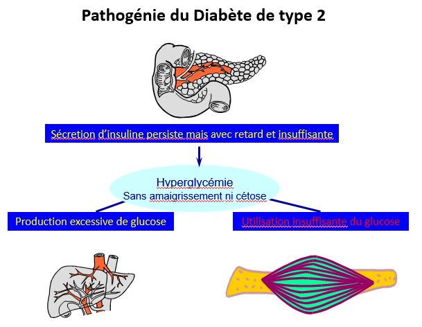 pathogenie du diabete1
